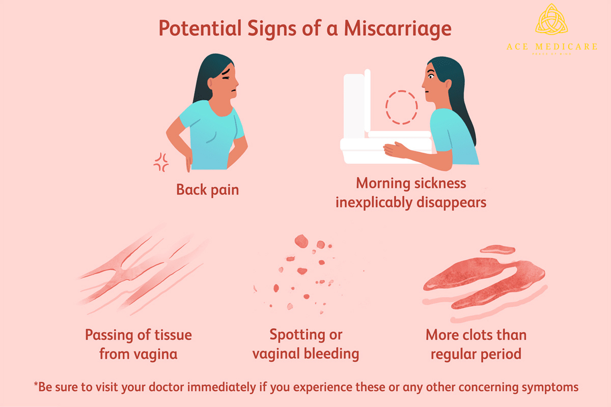 Pregnancy Following a Miscarriage